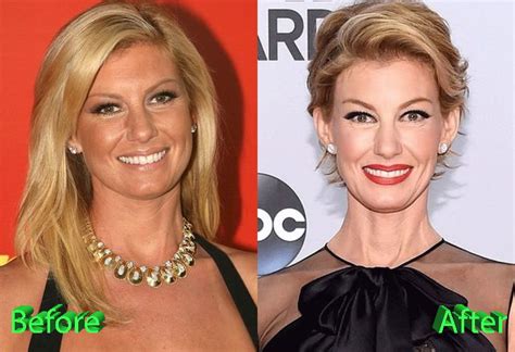 Faith Hill Has Had No Known Plastic。